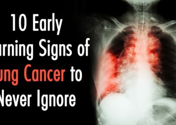 Early Lung Most cancers Warning Indicators That May Save Your Life