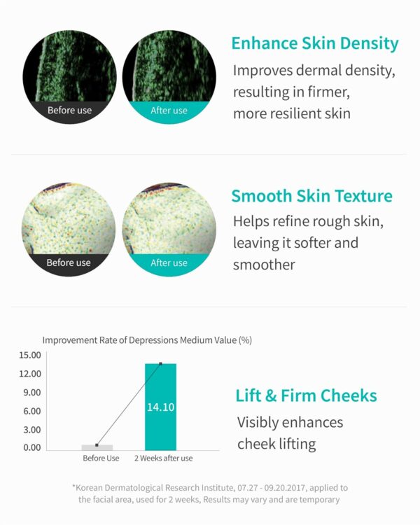 REJURAN® Turnover Ampoule, c-PDRN® - Original PDRN Anti-Aging Face Serum for Firmness, Radiance, and Youthful Glow. Korean Skin Care, Clinically Developed (1.01 fl oz) - Image 4