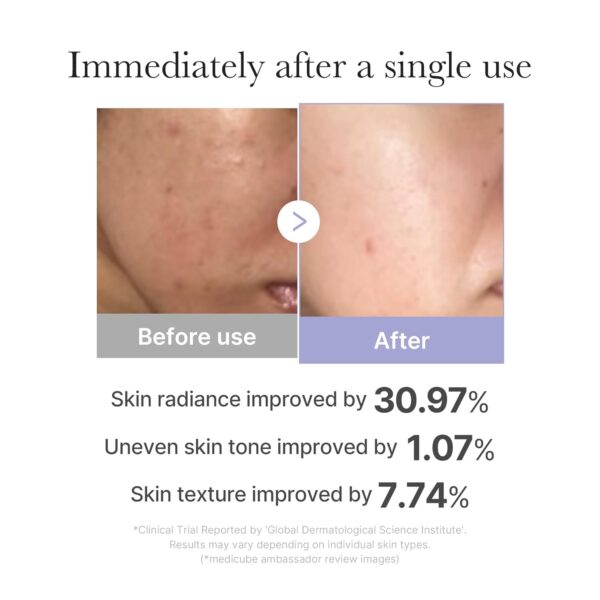 medicube Mini Booster Pro White | Affordable At-Home Facial Skin Care Tool for Beginners - Portable Glow Booster for Glass Skin, Boosting Skin Care Absorption, Skin care for teens, Korean Skin Care - Image 3