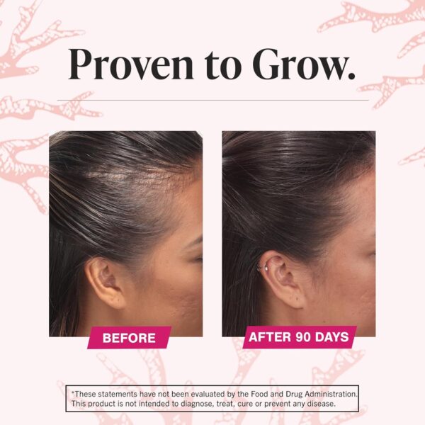 Viviscal Hair Growth Supplements For Women For Thicker, Fuller Hair, Nourishes Thinning & Loss, With Proprietary Collagen Complex, 180 Tablets, 3 Month Supply - Image 6