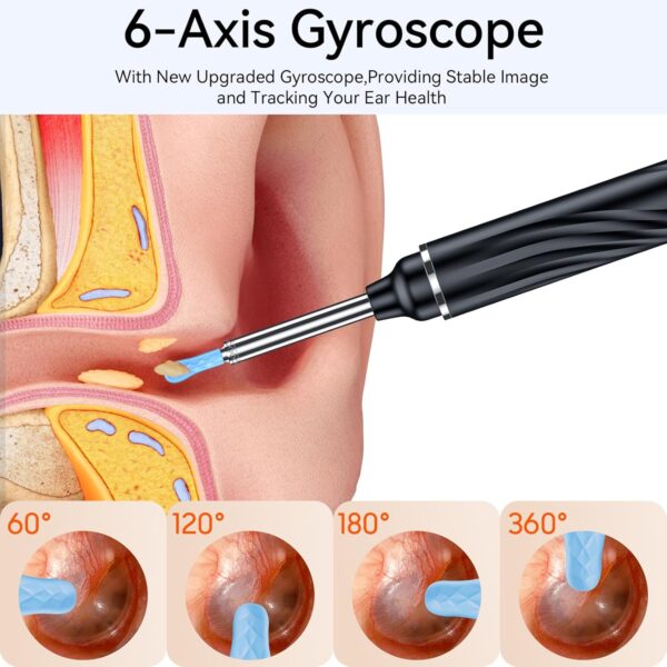 Ear Wax Removal Tool Camera, Ear Cleaner with Camera, 1080P HD Ear Camera and 6 LED Light, Ear Wax Removal Kit with 6 Ear Pick, 6 Pcs Ear Set, Ear Camera Wax Removal for iOS & Android, Black - Image 6