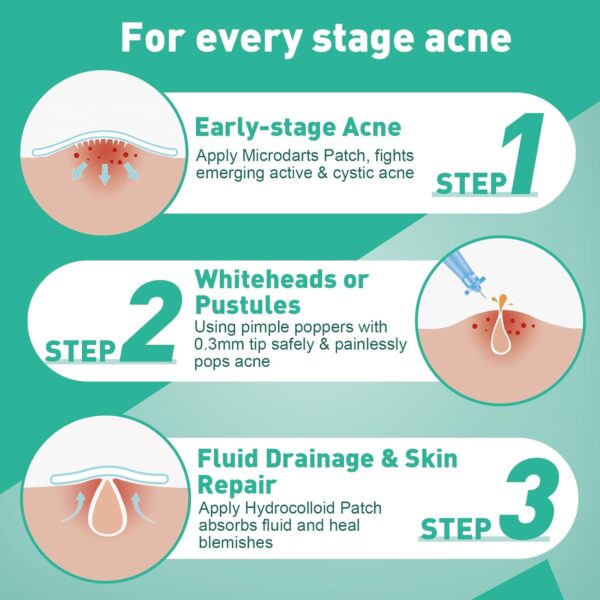 3-Step Microdart Pimple Patches Set - 9 Microdarts Pimple Patches, 50 Pimple Popper, 24 Hydrocolloid Patches - Image 2