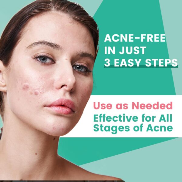 3-Step Microdart Pimple Patches Set - 9 Microdarts Pimple Patches, 50 Pimple Popper, 24 Hydrocolloid Patches - Image 7