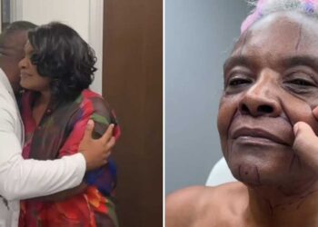 Mother Will get Facelift From Plastic Surgeon Son, Value Surprises Her