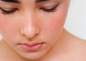 The Hyperlink Between Intestine Well being & Rosacea, From An Integrative Derm