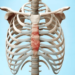 How Lengthy Does It Take to Get Compensation for Fractured Sternum?